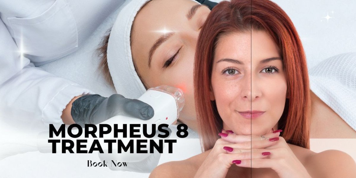 How Customization Improves Morpheus8 Results