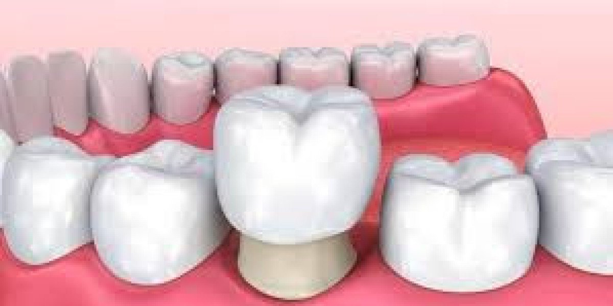 Teeth Capping vs Dental Filling: Which One Does Your Tooth Really Need?