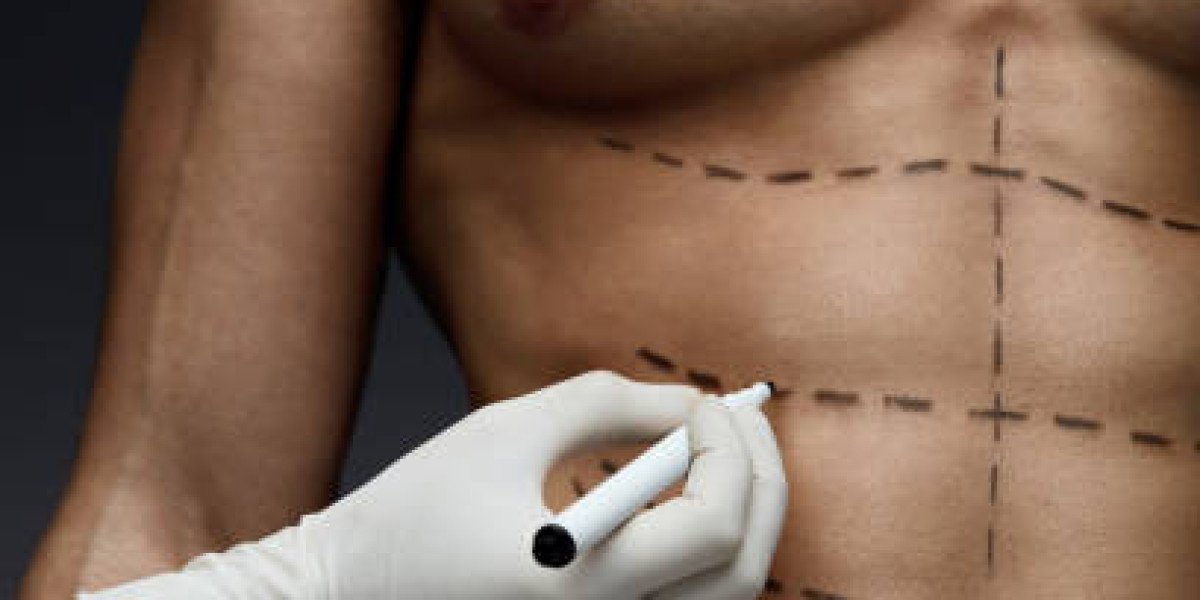 Understanding Fat Melting Injections for Effective Body Contouring