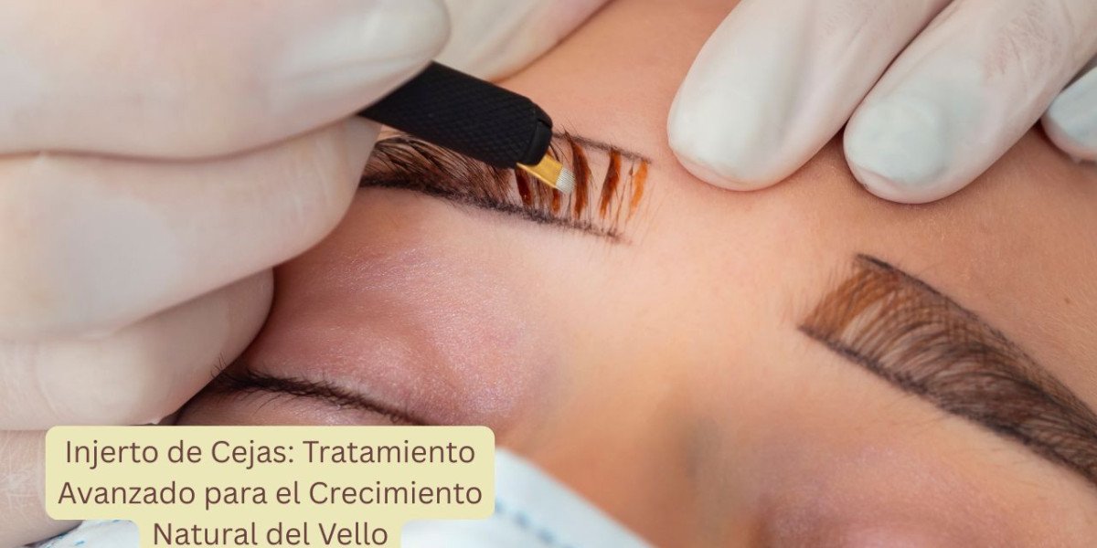 Injerto de Cejas: Tratamiento Avanzado para el Crecimiento Natural del Vello
