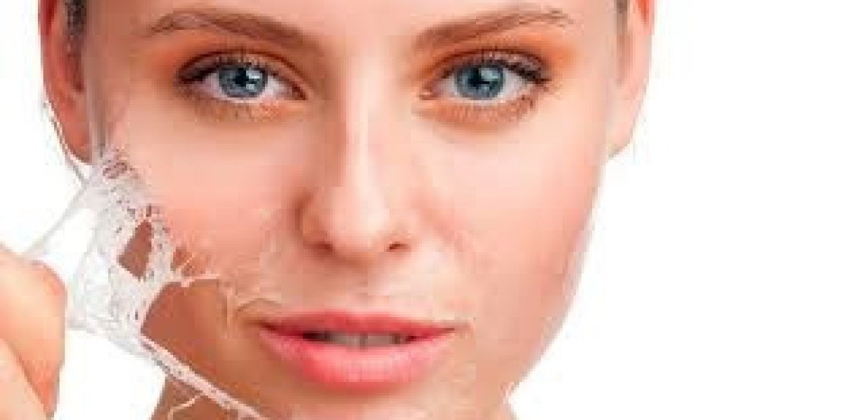 Chemical Peels in Islamabad: Choosing the Right Peel for Your Skin Type