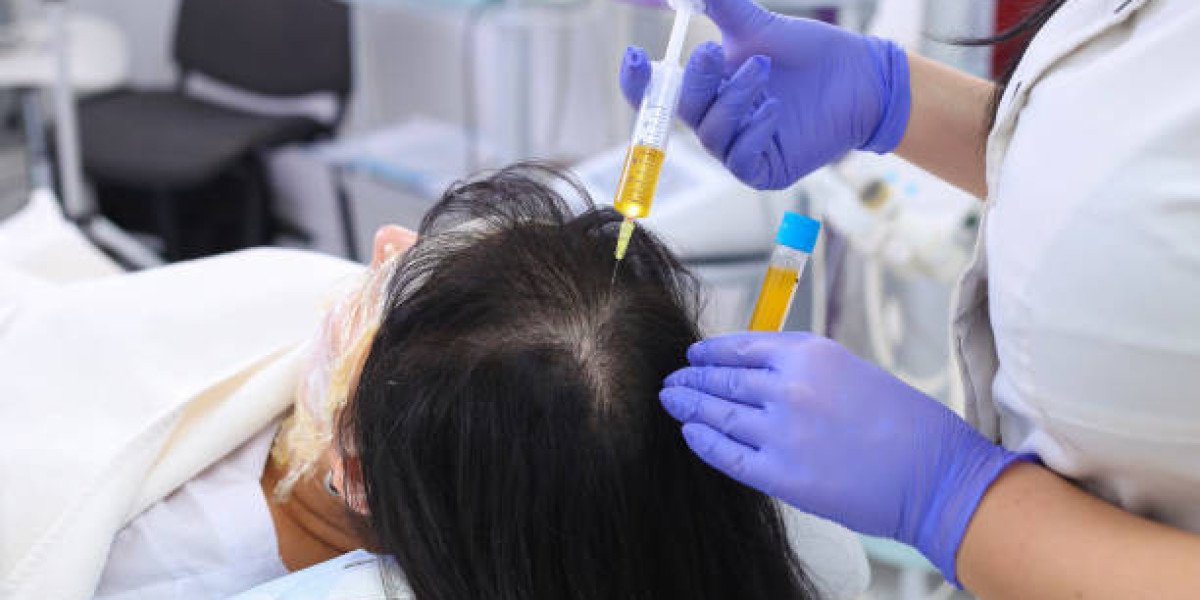PRP Hair Treatment Scalp Massage and Topical Care That Support Recovery