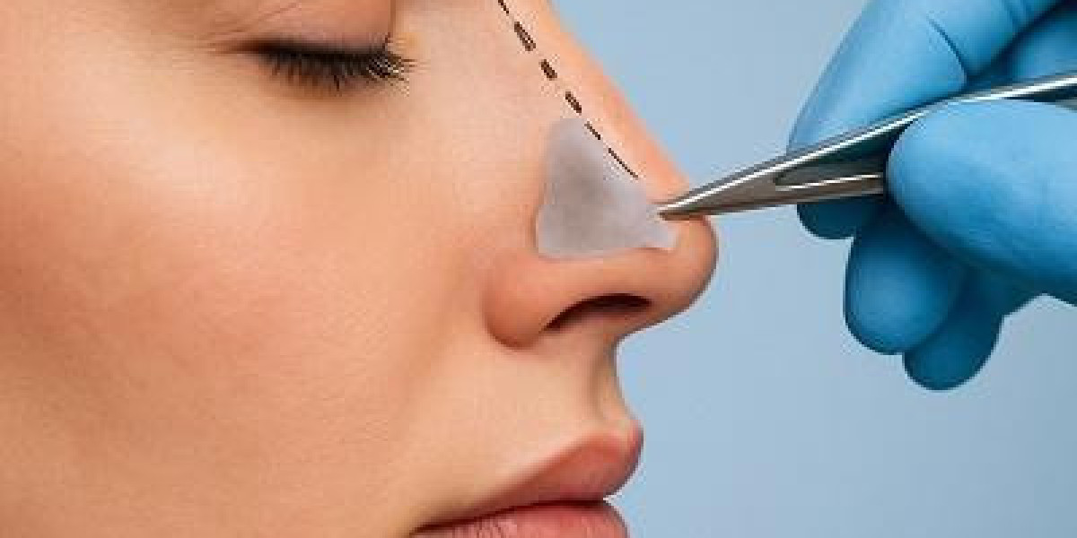 Can Glasses Affect Healing After Rhinoplasty Surgery?
